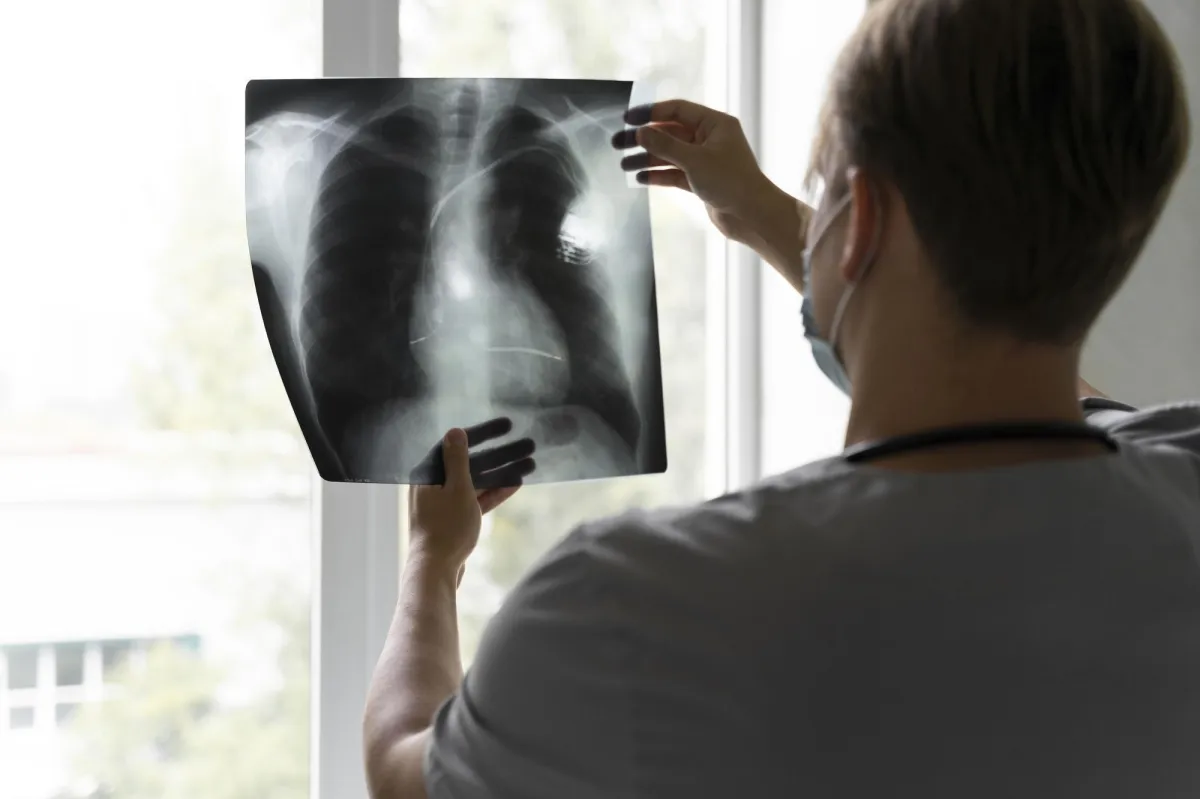 AI for Lung Cancer Diagnosis